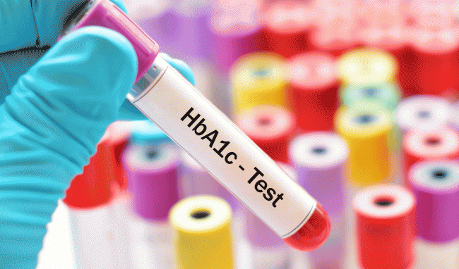 Chỉ số xét nghiệm HbA1c